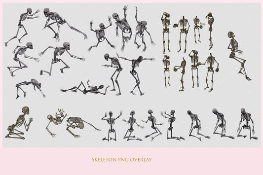 Skeleton Overlay